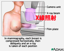 mammography.jpg